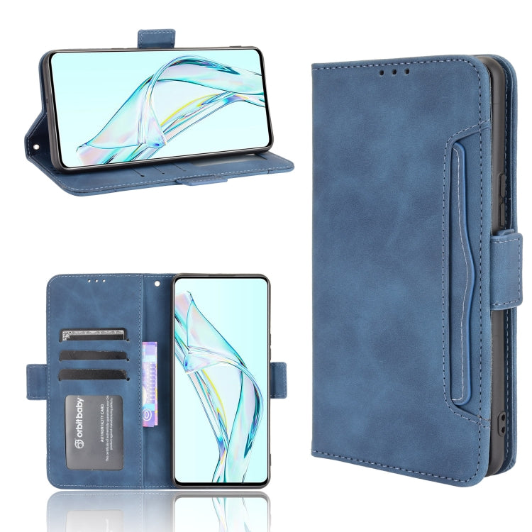 Skin Feel Calf Pattern Horizontal Flip Leather Case with Holder & Card Slots & Photo Frame, For Doogee S86 / S86 Pro, For Google Pixel 5a 5G, For Xiaomi Redmi 10, For Nokia C30, For Samsung Galaxy M21 2021, For Sony Xperia 10 III, For Xiaomi Mi Mix 4��...
